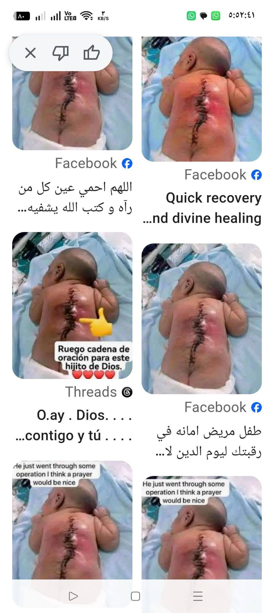 صورة واحدة وقصص متعددة.. كيف تُستغل معاناة الأطفال في جمع التبرعات أون لاين؟